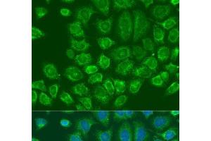 Immunofluorescence analysis of U2OS cells using MTDH Polyclonal Antibody at dilution of 1:100.