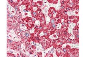 Anti-RBM38 antibody IHC staining of human liver. (RBM38 anticorps  (AA 41-90))