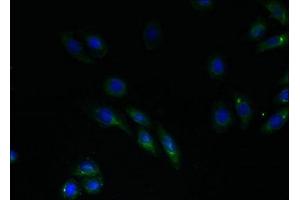 Immunofluorescent analysis of HepG2 cells using ABIN7151168 at dilution of 1:100 and Alexa Fluor 488-congugated AffiniPure Goat Anti-Rabbit IgG(H+L) (RNF183 anticorps  (AA 1-161))