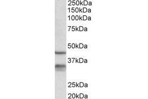 Western Blotting (WB) image for anti-Hydroxysteroid (11-Beta) Dehydrogenase 1 (HSD11B1) (Internal Region) antibody (ABIN2464932) (HSD11B1 anticorps  (Internal Region))