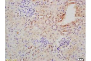 Formalin-fixed and paraffin embedded mouse kidney labeled with Rabbit Anti-NFKB Polyclonal Antibody, Unconjugated  at 1:200 followed by conjugation to the secondary antibody and DAB staining (NFKB2 anticorps  (AA 151-250))