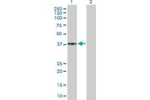 Western Blot analysis of CCR5 expression in transfected 293T cell line by CCR5 MaxPab polyclonal antibody. (CCR5 anticorps  (AA 1-352))