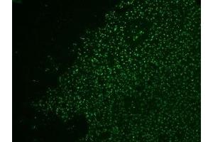 Formalin-fixed, paraffin-embedded human colon carcinoma stained with AF488 Conjugate of Nucleolin antibody.