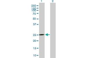 Western Blot analysis of MRPS10 expression in transfected 293T cell line by MRPS10 MaxPab polyclonal antibody. (MRPS10 anticorps  (AA 1-201))