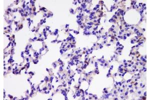 IHC analysis of TIMM17A using anti-TIMM17A antibody (ABIN6719637).