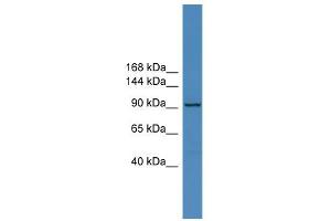 WB Suggested Anti-ZNF574 Antibody Titration:  0. (ZNF574 anticorps  (C-Term))