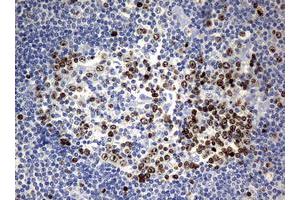 Image no. 6 for anti-Antigen Identified By Monoclonal Antibody Ki-67 (MKI67) (AA 1160-1493) antibody (ABIN1490857) (Ki-67 anticorps  (AA 1160-1493))