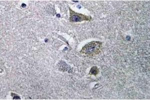 Immunohistochemistry (IHC) analyzes of NDUFV2 antibody in paraffin-embedded human brain tissue. (NDUFV2 anticorps)