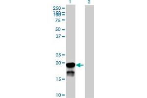 Western Blot analysis of BRSK2 expression in transfected 293T cell line by BRSK2 MaxPab polyclonal antibody.