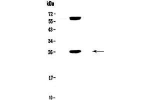 Western blot analysis of Bcl-2 using anti-Bcl-2 antibody . (Bcl-2 anticorps  (AA 118-165))
