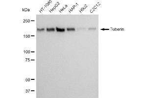 Western blotting analysis using Tuberin antibody (ABIN7800658).