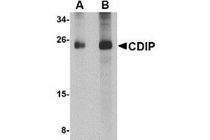 Image no. 1 for anti-LITAF-Like Protein (CDIP1) (Internal Region) antibody (ABIN478041) (CDIP1 anticorps  (Internal Region))