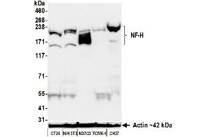 Western Blotting (WB) image for anti-Neurofilament, Heavy Polypeptide (NEFH) (AA 1040-1090) antibody (ABIN7453896)