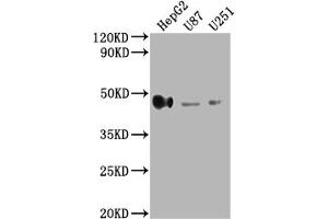 Western Blot Positive WB detected in: HepG2 whole cell lysate, U87 whole cell lysate, U251 whole cell lysate All lanes: HLA-G antibody at 1:2000 Secondary Goat polyclonal to rabbit IgG at 1/50000 dilution Predicted band size: 39, 28, 18, 37, 26, 14 kDa Observed band size: 45 kDa
