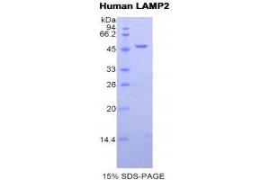 SDS-PAGE (SDS) image for Lysosomal-Associated Membrane Protein 2 (LAMP2) (AA 193-375) protein (His tag,GST tag) (ABIN1877974)