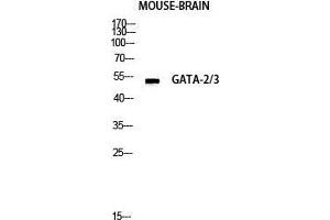 Western Blot (WB) analysis of Mouse Lung lysis using GATA-2/3 antibody. (GATA-2/3 anticorps  (Ser422))