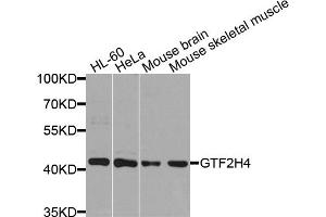 Western blot analysis of extracts of various cell lines, using GTF2H4 antibody.