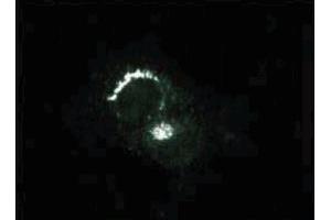 Immunofluorescence staining of PSFK-1 cells (Human neuroectodermal tumor line, ATCC CRL-2060).