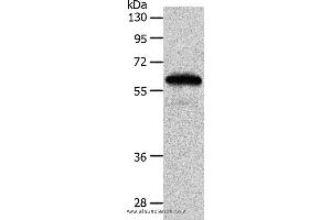 Western blot analysis of Mouse brain tissue, using INA Polyclonal Antibody at dilution of 1:550 (INA anticorps)