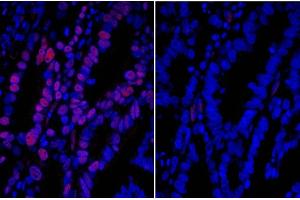 Immunofluorescence (IF) image for Donkey anti-Goat IgG (Heavy & Light Chain) antibody (DyLight 594) - Preadsorbed (ABIN7446334)