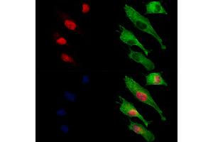 ABIN6261355 and ABIN6273229 staining HUVEC cells by IF/ICC.