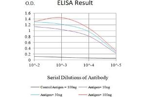 Black line: Control Antigen (100 ng),Purple line: Antigen (10 ng), Blue line: Antigen (50 ng), Red line:Antigen (100 ng)