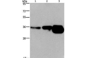 Western Blot analysis of Human breast infiltRative duct and fetal brain tissue, Mouse brain tissue using CUEDC2 Polyclonal Antibody at dilution of 1:600