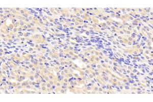 Detection of TIMP2 in Mouse Kidney Tissue using Polyclonal Antibody to Tissue Inhibitors Of Metalloproteinase 2 (TIMP2)