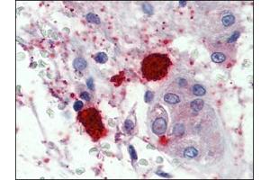 Testis, mast cells, Human: Formalin-Fixed, Paraffin-Embedded (FFPE) (CMA1 anticorps)
