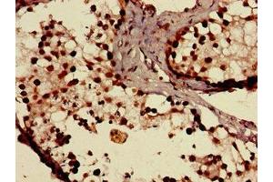 Immunohistochemistry of paraffin-embedded human testis tissue using ABIN7170295 at dilution of 1:100 (SLCO1C1 anticorps  (AA 297-348))