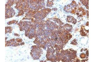 Image no. 1 for anti-Parathyroid Hormone (PTH) (C-Term) antibody (ABIN6166676)