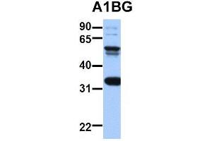Host:  Rabbit  Target Name:  EGFL8  Sample Type:  HepG2  Antibody Dilution:  1.