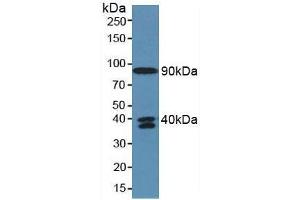 Detection of C4a in Human Serum using Polyclonal Antibody to Complement Component 4a (C4a) (C4A anticorps  (AA 680-756))