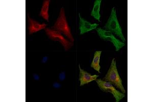 ABIN7093109 and ABIN7097600 staining  cells by IF/ICC. (XIRP1 anticorps)