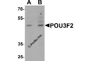 Western Blotting (WB) image for anti-POU Class 3 Homeobox 2 (POU3F2) (C-Term) antibody (ABIN1077394) (POU3F2 anticorps  (C-Term))