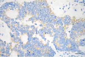 anti-Stomatin (EPB72)-Like 2 (STOML2) antibody