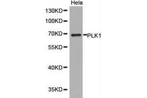 Western Blotting (WB) image for anti-Polo-Like Kinase 1 (PLK1) antibody (ABIN1874166) (PLK1 anticorps)
