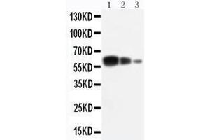 Anti-ADAM10 antibody, Western blotting Lane 1: Recombinant Human ADAM10 Protein 10ng Lane 2: Recombinant Human ADAM10 Protein 5ng Lane 3: Recombinant Human ADAM10 Protein 2.