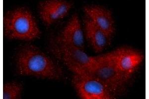 Immunofluorescence (IF) image for anti-Heparin-Binding EGF-Like Growth Factor (HBEGF) (AA 63-148) antibody (PE) (ABIN5567178) (HBEGF anticorps  (AA 63-148) (PE))