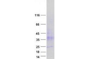 Validation with Western Blot
