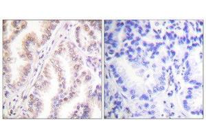 Immunohistochemistry (IHC) image for anti-Protein Inhibitor of Activated STAT, 1 (PIAS1) (N-Term) antibody (ABIN1848832) (PIAS1 anticorps  (N-Term))