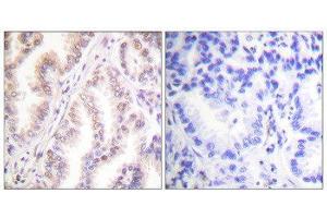 Immunohistochemistry (IHC) image for anti-Protein Inhibitor of Activated STAT, 1 (PIAS1) (N-Term) antibody (ABIN1848832)