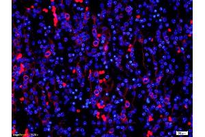 Formalin-fixed and paraffin-embedded mouse kidney labeled with Anti-PDCD4 Polyclonal Antibody, Unconjugated (ABIN731993) 1:200, overnight at 4°C, The secondary antibody was Goat Anti-Rabbit IgG, Cy3 conjugated used at 1:200 dilution for 40 minutes at 37°C.