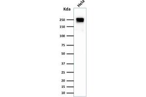 Western Blot Analysis of HeLa cell lysate using Spectrin beta III Monoclonal Antibody (SPTBN2/1584).
