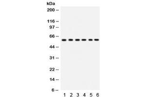 Western blot testing of 1) rat thymus, 2) rat lung, 3) HeLa, 4) 22RV1, 5) A431 and 6) mouse HEPA lysate with CYP24A1 antibody. (CYP24A1 anticorps  (AA 153-514))