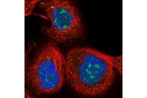 Immunofluorescent staining of human cell line A-431 with SOX7 polyclonal antibody  at 1-4 ug/mL shows positivity in nucleus, nucleoli and vesicles. (PINX1 anticorps)