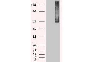 Image no. 5 for anti-Polo-Like Kinase 1 (PLK1) antibody (ABIN1500281)