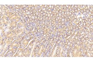 Detection of C3a in Mouse Kidney Tissue using Polyclonal Antibody to Complement Component 3a (C3a) (C3a anticorps  (AA 671-748))
