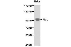 Western Blotting (WB) image for anti-Promyelocytic Leukemia (PML) antibody (ABIN1874171) (PML anticorps)