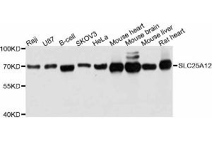 Western blot analysis of extracts of various cell lines, using SLC25A12 antibody.